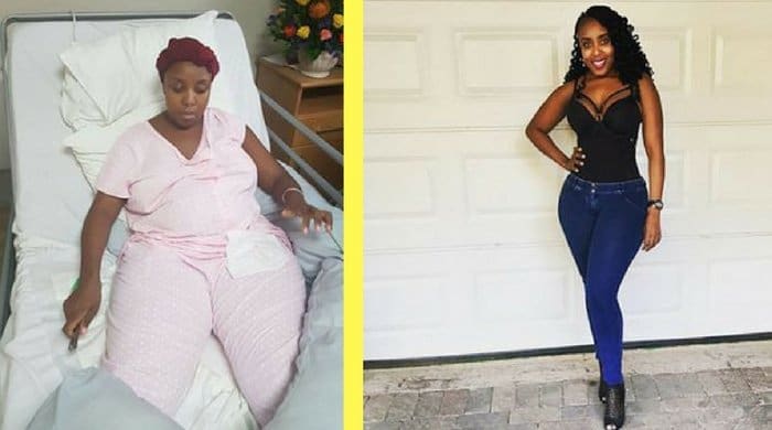 Toffo's before photo and after photo after losing her baby fat